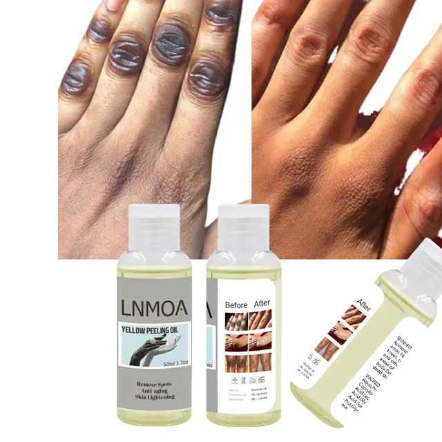 Weiße Haut Zitronen schalen öl drücken Melanin aufhellen aufhellen Peeling öl effektiv grünes Peeling öl