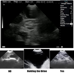 Veterinär-Ultraschalls canner Tragbare Schwangerschaft tests für Rinder Kuh Schwein Schaf Pferd Nutztiere Haustier - Product Image 5