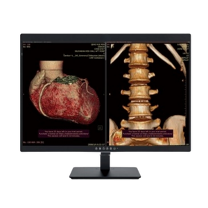 Moniteur médical abordable de qualité supérieure avec prise en charge de la calibration DICOM, assistance technique vétérinaire 24h/24 et 7j/7, <span class=keywords><strong>prix</strong></span> compétitifs pour les achats en gros - Product Image 1