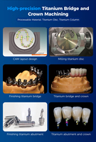 Gld Wet 5 Axis Cnc Fresadoras Titanio en blanco Premilled Abutment Auto Cad Cam Dental Cad Cam Fresadoras