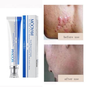 ครีมฟรีสำหรับทดลองใช้ บรรเทารอยแตกลาย รอยแผลไฟไหม้ ซ่อมแซมผิวหน้า ลดรอยแผล<span class=keywords><strong>เป็น</strong></span> ครีมลบรอยแผล<span class=keywords><strong>เป็น</strong></span>สำหรับรอยแผล<span class=keywords><strong>เป็น</strong></span>เก่า - Product Image 2