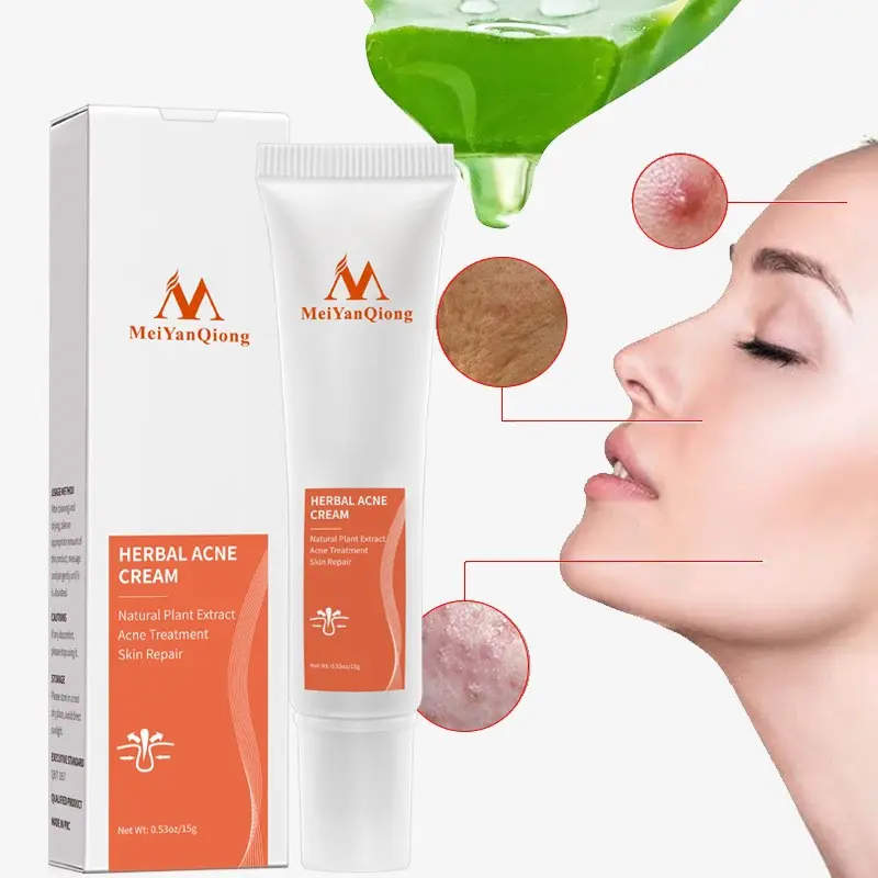 Hot Koop Kruiden Crème Voor Acne Krimpen Poriën Behandeling Van Acne Houden Weg Van Grove Poriën Gezicht Anti Acne Whitening Cream