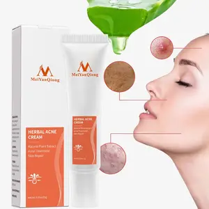 Hot Koop Kruiden Crème Voor Acne Krimpen Poriën Behandeling Van Acne Houden Weg Van Grove Poriën Gezicht Anti Acne Whitening Cream