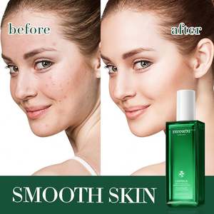 Tónico Hidratante Calmante con Centella Asiática FAYANKOU de Marca Privada Coreana, <span class=keywords><strong>Astringente</strong></span> Hidratante para Todo Tipo de <span class=keywords><strong>Piel</strong></span> - Product Image 5