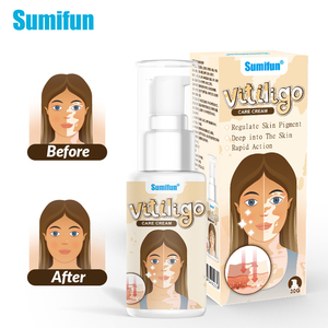 Crème Pommade Soulageant les Taches Blanches pour le Corps Traitement aux Plantes pour la Peau Crème pour le <span class=keywords><strong>Vitiligo</strong></span> Plâtre Chinois Ciblé pour l'Élimination des Taches - Product Image 1
