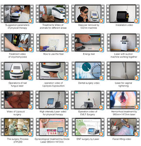 Endolazer Çift Dalgalı Fiber Kanül 1470nm Medikal Diyot Lazer Yüz Germe Lipoliz Lazer Liposuction Cihazı - Product Image 4