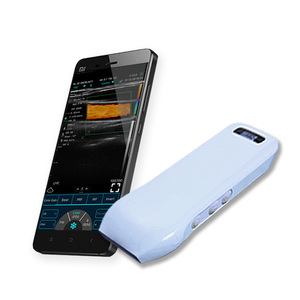 Sonda <span class=keywords><strong>de</strong></span> Ultrasonido <span class=keywords><strong>Doppler</strong></span> Lineal Inalámbrica Konted MDR C10CX, Equipo <span class=keywords><strong>de</strong></span> Imagenología Médica, Fisioterapia por Ultrasonido - Product Image 5
