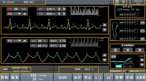 Nueva máquina EECP lanzada con función de impresora <span class=keywords><strong>para</strong></span> el tratamiento de enfermedades cardíacas - Product Image 2