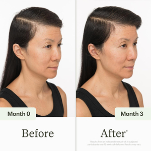 เซรั่มบำรุงหนังศีรษะสูตรเฉพาะสำหรับแบรนด์ OEM ผสมคอปเปอร์เปปไทด์ คาเฟอีน และน้ำมันทีทรี สำหรับ<span class=keywords><strong>ผม</strong></span>บาง ช่วยเร่งการเจริญเติบโตของเส้นผม ป้องกันผมร่วง - Product Image 5