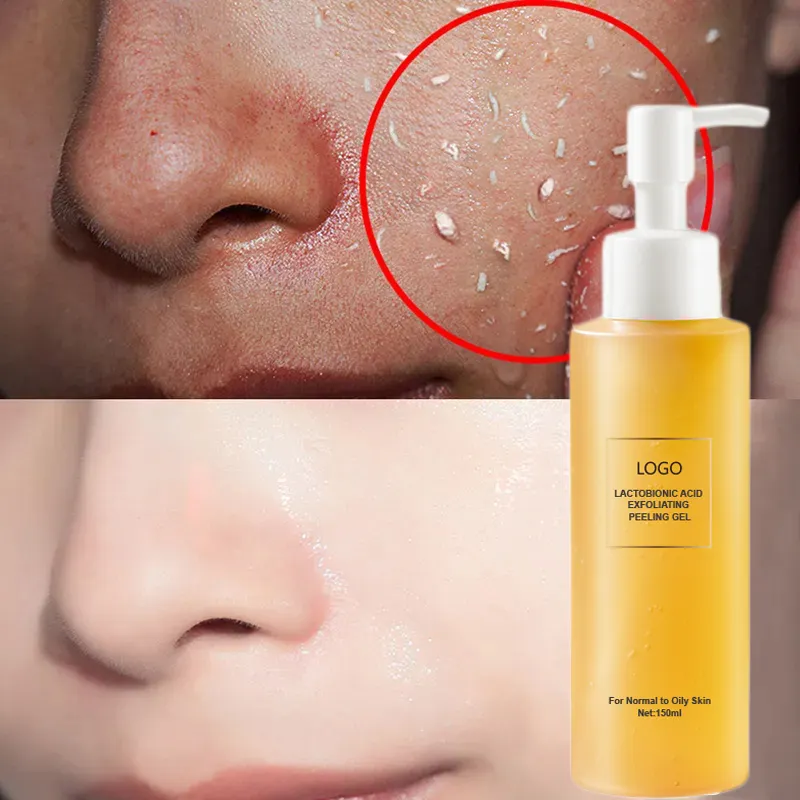Lactobionic Acid Pore Blackheads Removal Whitening Face Wash Skin Scrub Peeling Enzyme Exfoliating Gel Skincare Facial Cleanser