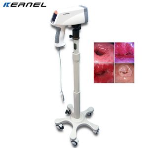 स्त्रीरोग के लिए पोर्टेबल डिजिटल इलेक्ट्रॉनिक वीडियो कोपोस्कोप योनि परीक्षा के लिए - Product Image 1