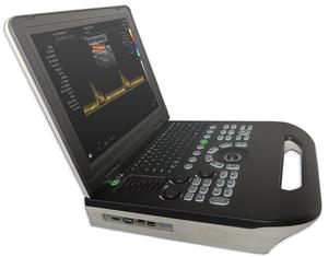 Kustomisasi jantung OB GYN mesin ecocardiografi Laptop pemindai Ultrasound portabel Ecografo Portatil - Product Image 5