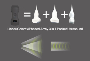 MC26 192 Elements Probe Ultrasound Doppler Nirkabel Portabel Inovatif untuk Mendeteksi Setiap Ketidaknormalan Kecil di Ponsel - Product Image 2
