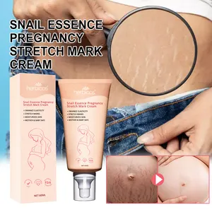 OEM/ODM krim perbaikan tanda kerutan organik alami ekstrak siput untuk rumah Krim penghilang Stretch Mark kehamilan Postpartum ibu