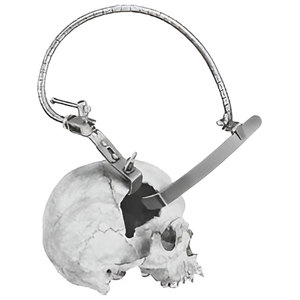 Retrattore Spinale Manuale <span class=keywords><strong>Leyla</strong></span> di Qualità Premium, Personalizzato, Riutilizzabile, Sterilizzato ad Alta Temperatura, Strumenti in Acciaio Inossidabile - Product Image 3