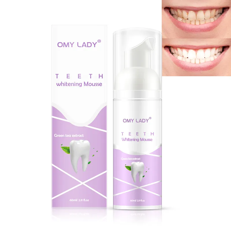 OMY LADY-kit de blanqueamiento dental profesional