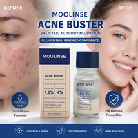 Traitement liquide anti-acné à l'acide salicylique, personnalisé OEM, très vendu à l'international, avec Quaternium-73 et Niacinamide pour éliminer les boutons et les imperfections.