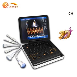 SUN-906A Dispositivo de Diagnóstico por Ultrasonido Doppler a Color Totalmente Digital, Máquina de Ecografía Cardiovascular - Product Image 1