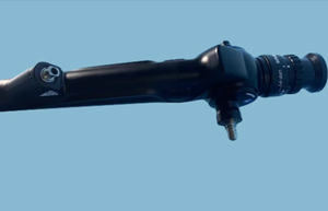 Reparación de uretero-renoscopio electrónico de calidad OEM con Envío Mundial 30% Precio de fabricantes/representantes de ventas - Product Image 2