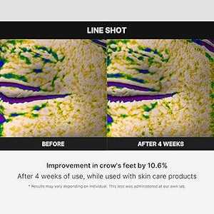 MEDICUBE AGE-R I-Shot 120g - Masajeador Facial y de Cuello Portátil para Rejuvenecimiento y Contorneado - Dispositivo de Belleza Coreano Más Vendido - Product Image 2