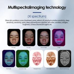 Máquina analizadora de piel con escáner facial <span class=keywords><strong>5D</strong></span> con tecnología IA KES New y pantalla de 2K de 21,5 pulgadas con cabezal de detección de cuero cabelludo al precio más bajo - Product Image 6