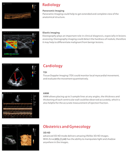 De Kleur Doppler Ultrasone Machine Wordt Standaard Geleverd Met Convexe En Lineaire Array Sondes Met 4d Software Voor Gratis Mslcu48 - Product Image 2