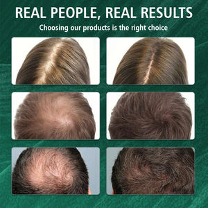 Joynna Platycladi Bamboo <span class=keywords><strong>Glam</strong></span> Nuts Paquete de montaje Triángulo Caja Cuero cabelludo Polygonum Multiflorum Barra de champú - Product Image 5