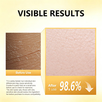 Solution Tonifiante Visage au Curcuma Marque Blanche pour Peaux Grasses – Soin Éclaircissant, Hydratant et Hydratant – Brume Faciale Cosmétique Essentielle