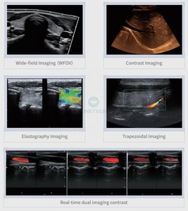 TC-6T ONETECH Appareil d'échographie obstétricale 2D/4D/5D homologué CE avec sonde convexe linéaire cardiaque pour l'analyse de la thyroïde - Product Image 5