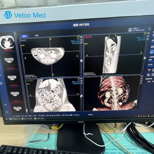 Máquina de Diagnóstico Veterinario por Rayos X, Escáner de Tomografía Computarizada (TC) Móvil para Animales Exóticos, Alta Resolución, Tamaño Compacto - Product Image 6