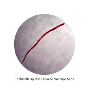 Lames de microscope histologiques fabriquées en usine, préparations de larves de Trichinella spiralis pour la science médicale et l'enseignement scolaire - Product Image 1