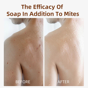 <span class=keywords><strong>Savon</strong></span> Corporel Rectangulaire au Curcuma Bio Naturel, Meilleure Vente en Gros, Élimine les Peaux Mortes, Blanchit les Peaux Grasses, Formule Végétale - Product Image 3