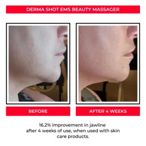 2024 équipement de beauté Ems Led vibrant Anti-âge masseur facial peau raffermissant visage beauté masseur facial baguette de thérapie