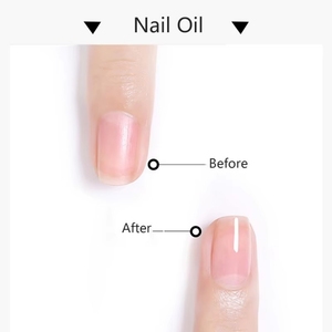 Aceite Nutritivo para Cutículas <span class=keywords><strong>de</strong></span> Uñas <span class=keywords><strong>de</strong></span> 15 ml con Logotipo Personalizado, Aceite para el Cuidado Diario <span class=keywords><strong>de</strong></span> las Uñas, Flores Secas <span class=keywords><strong>de</strong></span> <span class=keywords><strong>Plantas</strong></span>, Exfoliante para el Cuidado Personal, Tamaño <span class=keywords><strong>de</strong></span> Viaje - Product Image 5