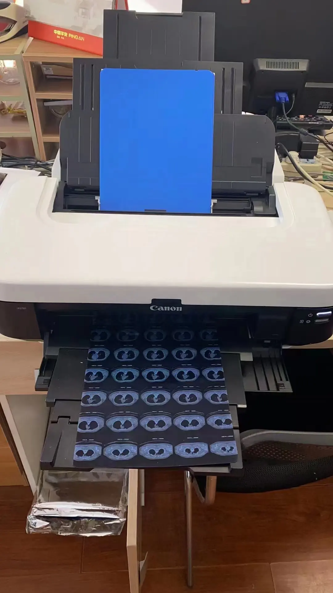 Alta qualidade Image Printing X-ray Film Blue Medical Film Para Inkjet Printer Waterproof
