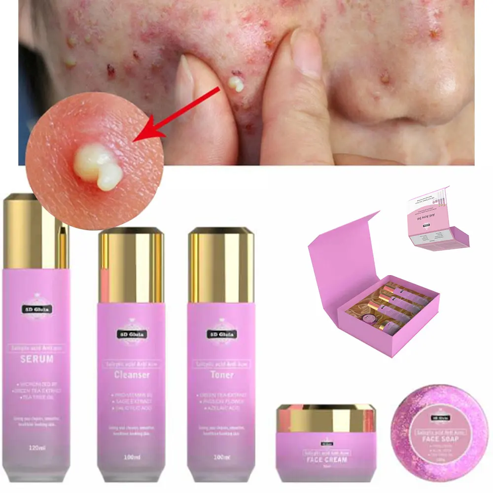 5D Gluta crème anti-acné professionnelle marque privée supprimer les boutons traitement de l'acné sérum anti-acné ensemble de soins de la peau