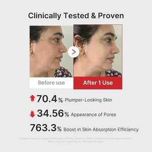 Masajeador Facial 6 en 1 Age-R Booster Pro con Cabezal de Vidrio Real, Recargable por USB, para una Piel Radiante, Dispositivo de Belleza Coreano - Product Image 5