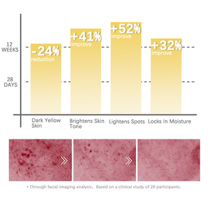 R suero de glutatión antioxidante EGF mejora el envejecimiento polvo liofilizado blanqueamiento removedor de manchas oscuras suero Multi glutatión - Product Image 3
