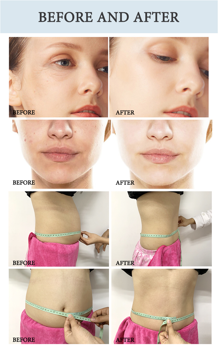 Hot sale weight loss 5 in 1 High Quality Ultra Cavitation Rf Vacuum Slimming Machine CE certificate