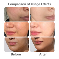 Crème de beauté éclaircissante à l'alpha-arbutine 150 ml, hydratante, éclaircissante, conforme aux normes de sécurité cosmétique, certifiée GMPC