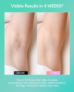 Épilateur électrique IPL JD-TM022, indolore et portable, pour le visage, le corps, les jambes, les bras et la zone du bikini - Product Image 5