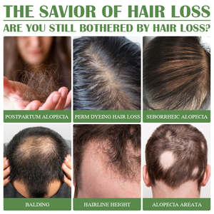 Spray Brume Épaississant au Gingembre pour la Croissance des Cheveux de Marque Privée 30ml 120ml Anti-Chute Non Gras Nourrissant Soin Capillaire Naturel - Product Image 4