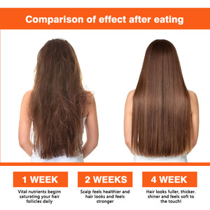 Private Label Biotin <b>Collagen</b> Hair Gummies with Biotin Hyaluronic Acid Beauty Skin Hair Nails Support Provides Intense - Product Image 2