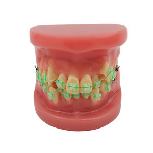 Modelo de Demostración de Ortodoncia para Educación Dental con 28 Piezas de Dientes y Brackets de Cerámica - Product Image 1