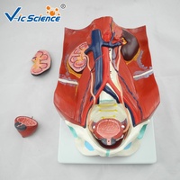 Modelo Anatómico del Sistema Urinario Humano, Modelo de Riñón, Uréter, Vejiga y Uretra para Enseñanza Médica en Urología, CE/ISO/ROHS/CNAS