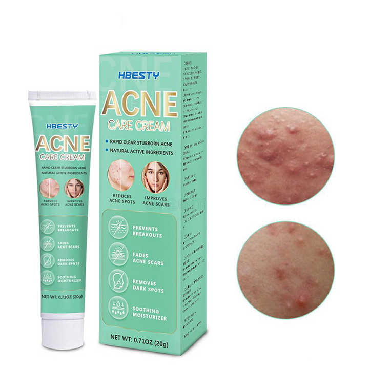 Private Label Herbal Natural Acne Treatment Scar Repair Pimple Removal
