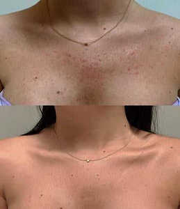 Gant exfoliant en soie 100% soie turque exfoliant en profondeur épurateur corporel élimination de la peau morte exfoliant pour le corps lisse la peau - Product Image 3