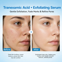 Sérum Visage Éclaircissant Marque Blanche OEM/ODM à l'Acide Tranexamique, Acide Azélaïque et Acide Hyaluronique pour Anti-Âge, Teint Terne et Éclat