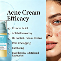 Crème anti-acné à l'acide salicylique sans sulfate pour la réparation des cicatrices d'acné, efficace et rapide, équilibrante pour l'huile, idéale pour les cicatrices d'acné récurrentes - Vente en gros