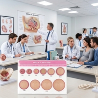 Modèle de dilatation cervicale en silicone 1cm-10cm, modèle de démonstration de dilatation du col de l'utérus pour l'enseignement et la formation en obstétrique et en sage-femme